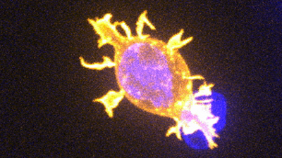 Killer T cells attacking cancer's image