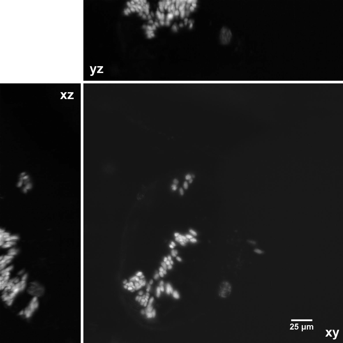 Zebrafish Eye, Light Sheet Imaging, Max Intensity Projection - Transplanted Clones's image